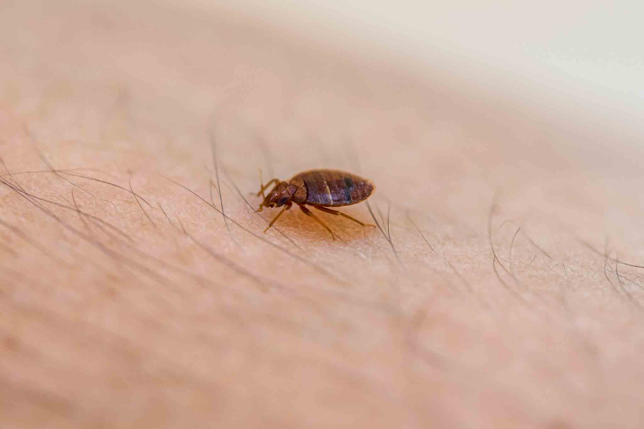 A bed bug sitting on an arm, choose Rest Easy Pest Control Nassau County for pest control.