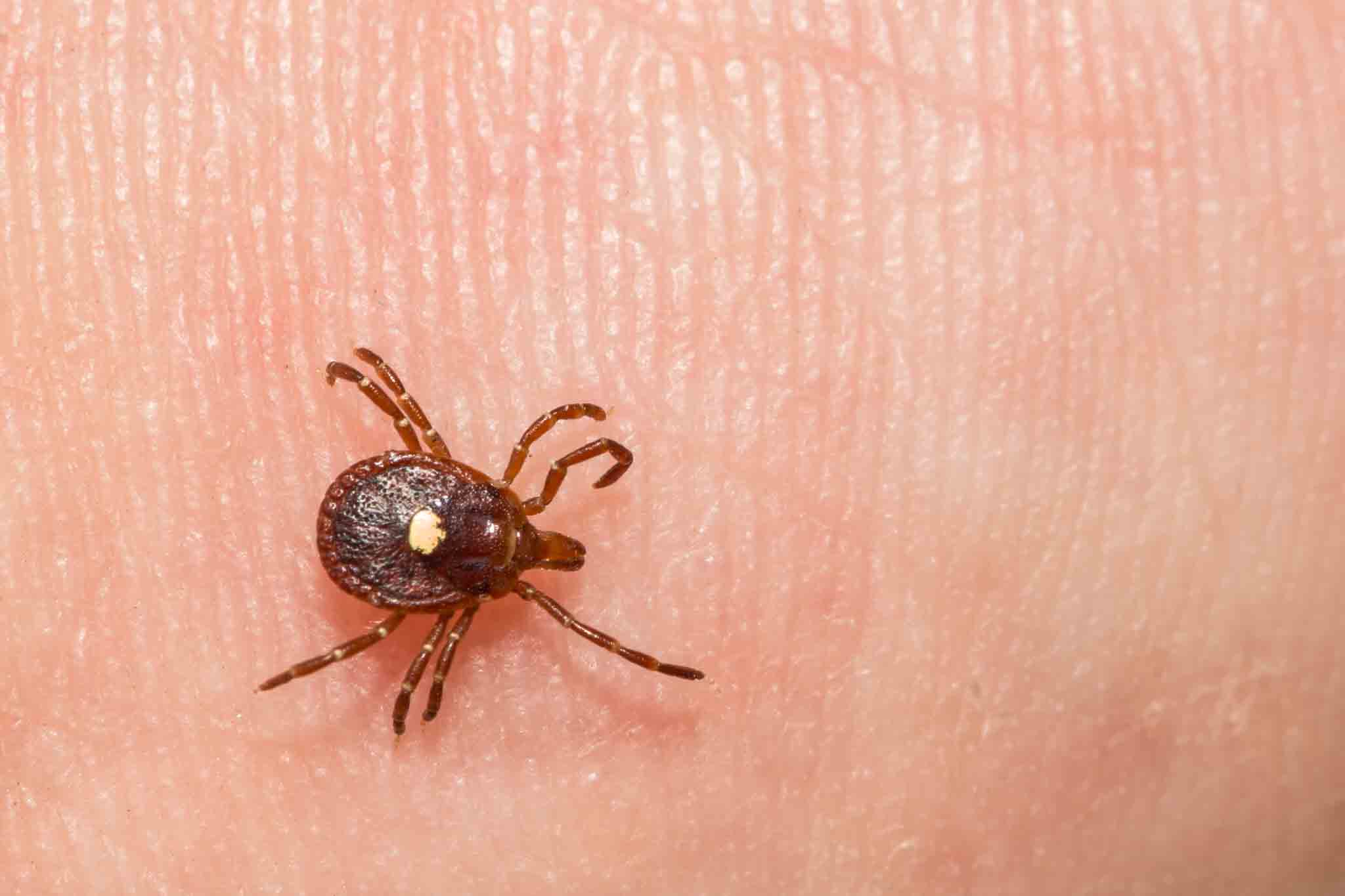 A brown tick on a human hand, choose Rest Easy Pest Control Suffolk County services.